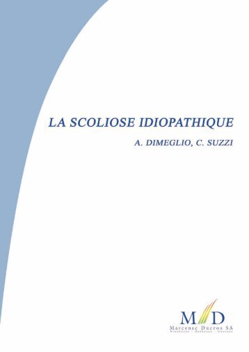 La scoliose idiopathique - Marcenac et Ducros