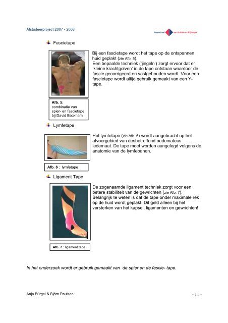 SCRIPTIE scoliose 08.Juni 2008 VERSION4.pdf - Tapingbase