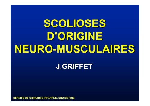 SCOLIOSES D'ORIGINE NEURO-MUSCULAIRES - SOFOP