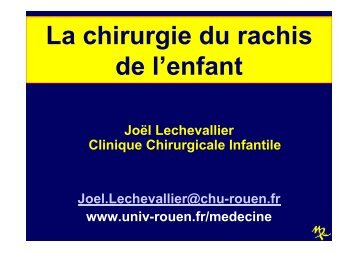 La chirurgie du rachis de l'enfant - CHU de Rouen