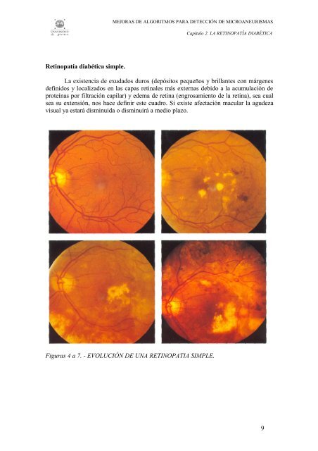 2.RETINOPATIA DIABETICA.pdf