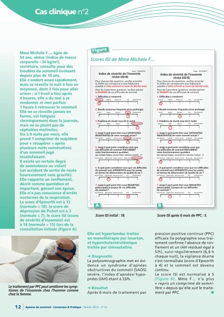 Cas clinique n°2 - Consensus Online