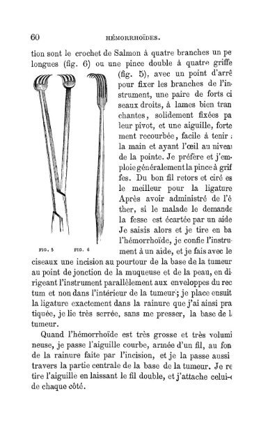 maladies du rectum