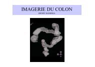 IMAGERIE DU COLON II B.ppt [Lecture seule] [Mode de ... - sofomec