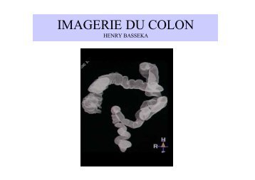 IMAGERIE DU COLON II B.ppt [Lecture seule] [Mode de ... - sofomec