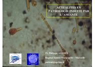 actualites en pathologie induite par l 'amiante - SISTEPACA