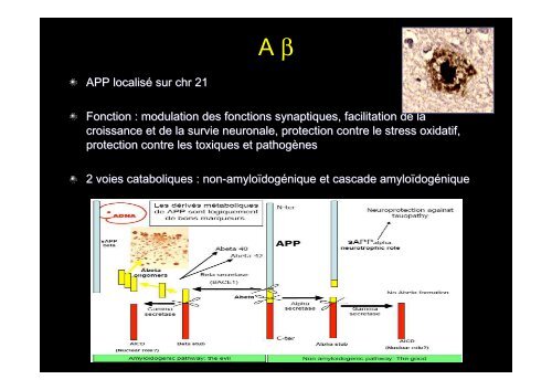 Classification des Démences