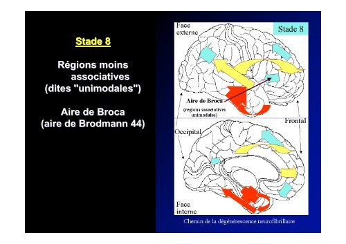 Classification des Démences