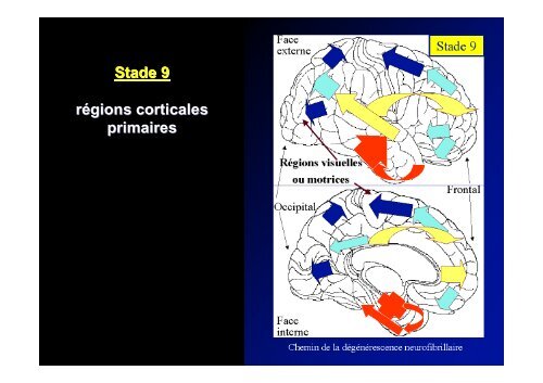 Classification des Démences