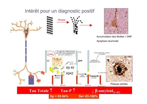 Classification des Démences