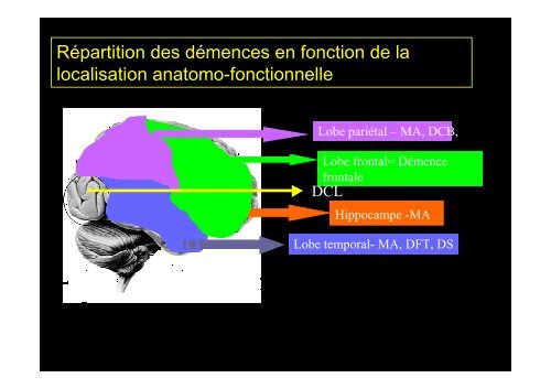 Classification des Démences