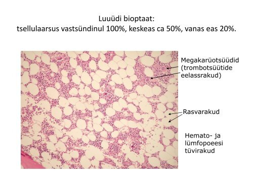 VERELOOMEKOE HAIGUSTE PATOLOOGIA