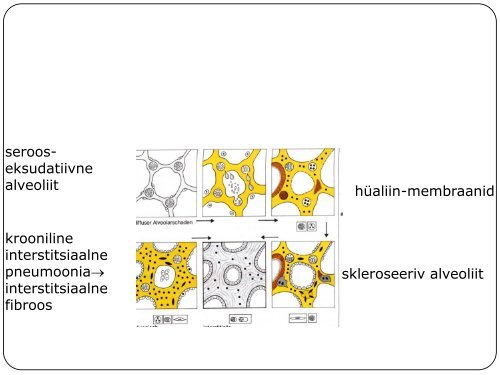 HINGAMISTEEDE HAIGUSED