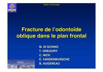 Fracture de l'odontoïde oblique dans le plan frontal. - ClubOrtho.fr
