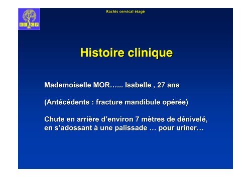 Fracture de l'odontoïde oblique dans le plan frontal. - ClubOrtho.fr