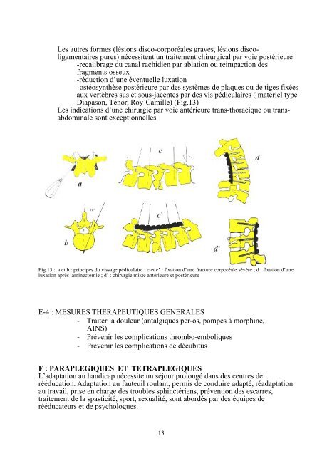 Traumatologie du rachis - Campus de Neurochirurgie