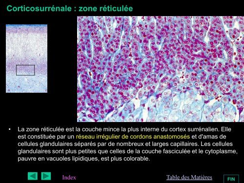 HISTOLOGIE DES GLANDES ENDOCRINES - epathologies