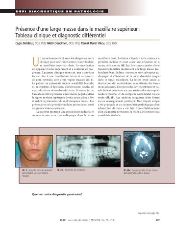Présence d'une large masse dans le maxillaire supérieur : Tableau ...