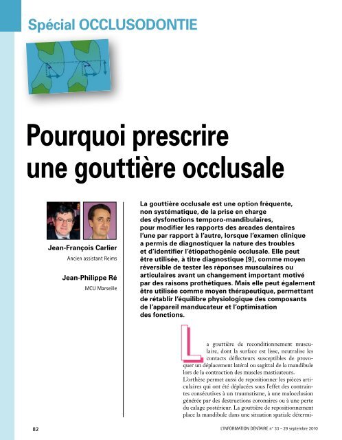 Une Gouttiere De Stabilisation Information Dentaire