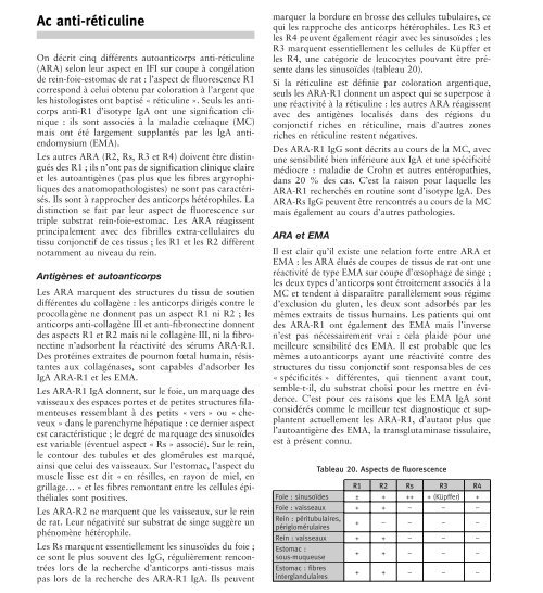 Anti Reticulin Ac anti-réticuline