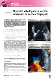 Etude des valvulopathies médica- menteuses en échocardiographie