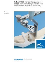 Gabarit TPLO standard et guides de sciage ... - Synthes