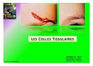 Les colles tissulaires - Euro-Pharmat