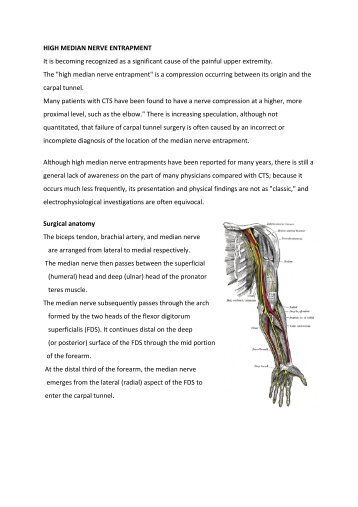 HIGH MEDIAN NERVE ENTRAPMENT It is becoming ... - Bonefix