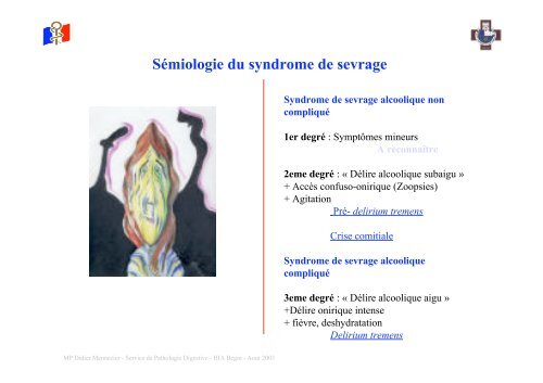 Sémiologie du syndrome de sevrage - Hepato Web