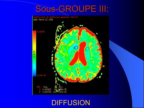 Sous-GROUPE III