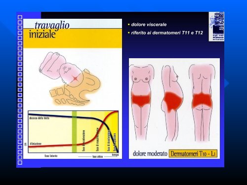 Il Dolore Ostetrico