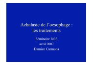 Achalasie de l'oesophage : les traitements - Hepato Web