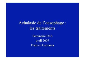 Achalasie de l'oesophage : les traitements - Hepato Web