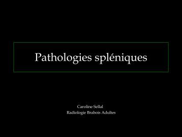 Pathologies spléniques CS(FILEminimizer) - RADIOLOGIE BRABOIS