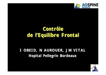 Contrôle de l'équilibre frontal