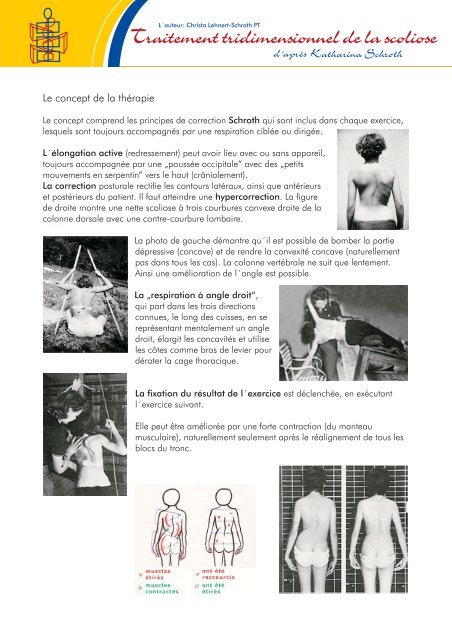 Traitement tridimensionnel de la scoliose - Dreidimensionale ...