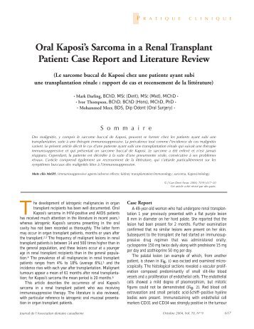 Oral Kaposi's Sarcoma in a Renal Transplant Patient - Canadian ...