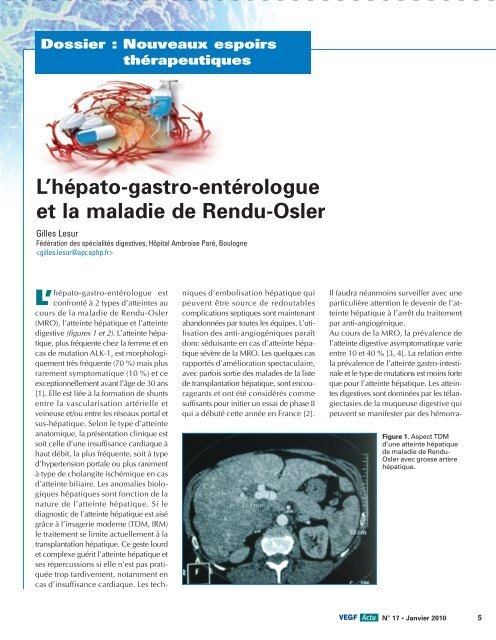 L'hépato-gastro-entérologue et la maladie de Rendu-Osler