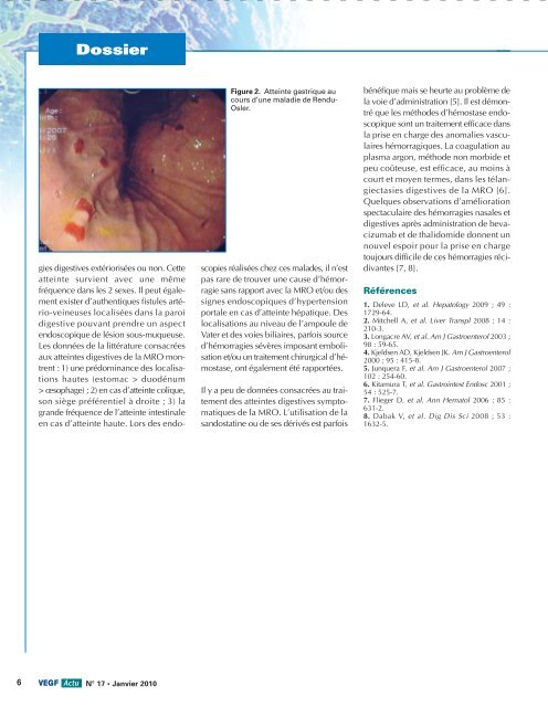 L'hépato-gastro-entérologue et la maladie de Rendu-Osler