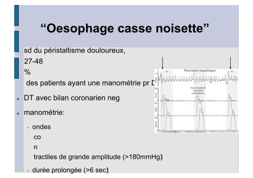 Douleurs thoraciques non angineuses - Hepato Web