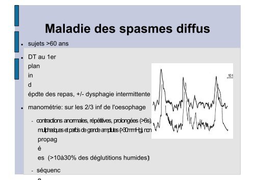 Douleurs thoraciques non angineuses - Hepato Web