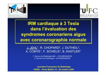 IRM cardiaque à 3T dans l'évaluation des syndromes coronariens ...