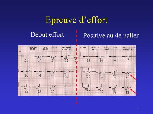 La coronaropathie en 2010