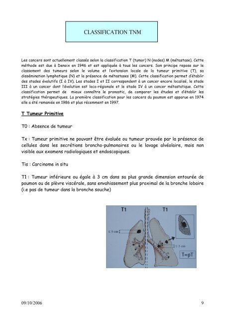 Thésaurus cancer du poumon - GOThA (Groupe d'Oncologie ...