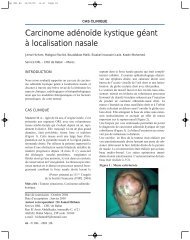 Carcinome adénoïde kystique géant à localisation nasale