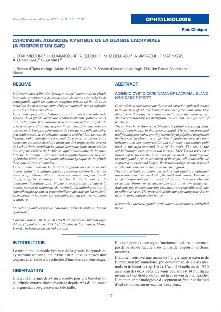 OPHTALMOLOGIE - Lazraq info