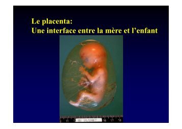 Pathologie du placenta