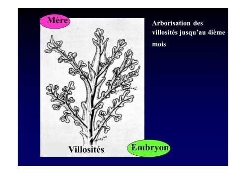 Pathologie du placenta