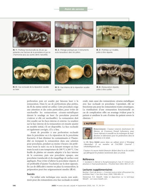 JADC - Canadian Dental Association