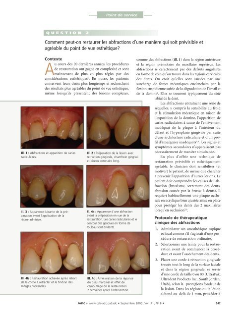 JADC - Canadian Dental Association